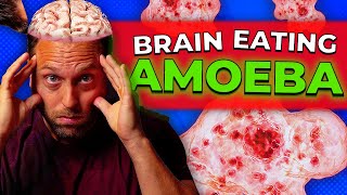 Can Dogs Contract This Brain Eating Amoeba?