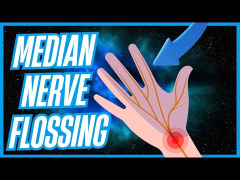 Median Nerve Flossing or Gliding for Carpal Tunnel Syndrome