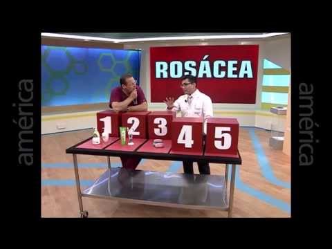 Rosácea: Que hacer para atenuar la rosácea y cuidar la piel entrevista en Dr. Tv al Dr. Aparcana