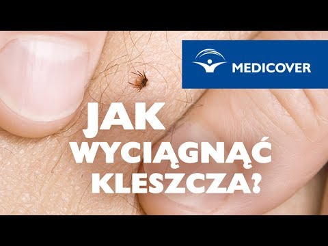 Jakie szkolenie pompuje mięśnie Mięsień czworoboczny sprawuje górę