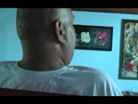 Dutch patient on Naltrexone implant