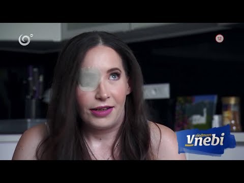 Ivanka si kvôli deformovanej tvári prešla peklom (V SIEDMOM NEBI)