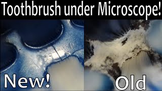 Download lagu Old vs New toothbrush under microscope. When should I replace my tooth brush? mp3