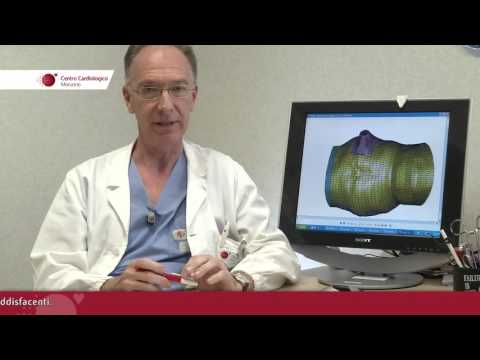 Intervista Prof. Gianluca Polvani, Responsabile UO Cardiochirurgia 2 del Monzino - 1