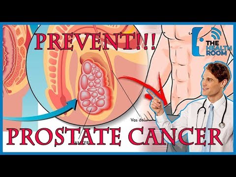 qual è il test di decifrazione per il cancro alla prostata