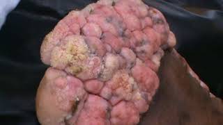 Back with Centrine: Mossy Foot and Jiggers (3 of 3)