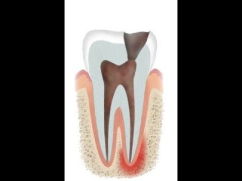 Aurachirurgie - Zahngesundheit Teil 2
