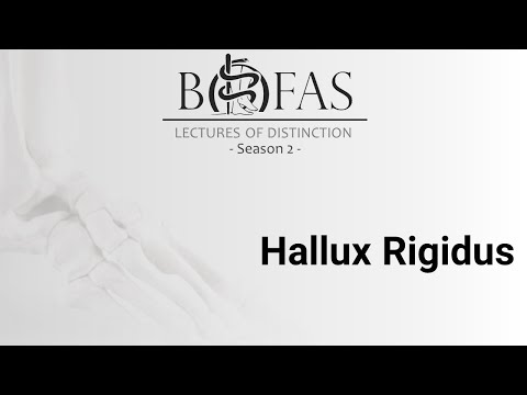 Hallux Rigidus - BOFAS Lectures of Distinction