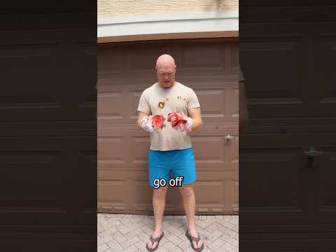 Real things I’ve seen as a Firefighter. It’s always the last firework. #fireworks #hand #firefighter