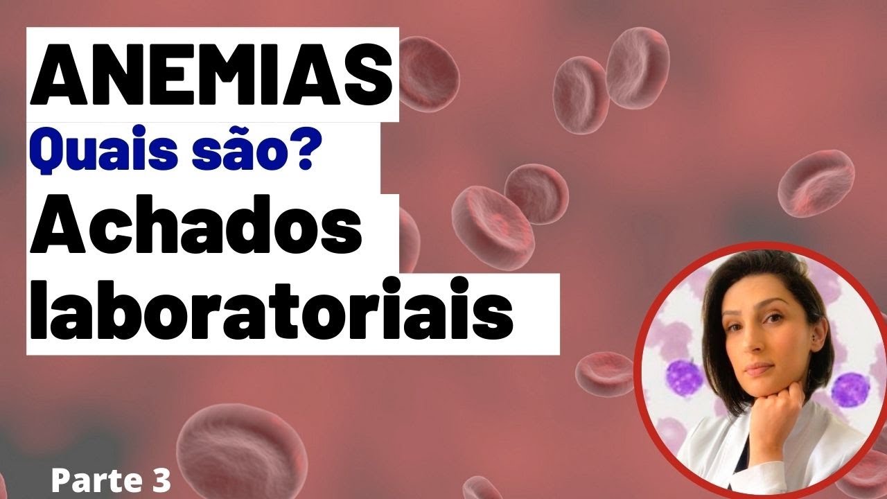 Anemias Achados Laboratoriais Biomedicina - Análises clínicas