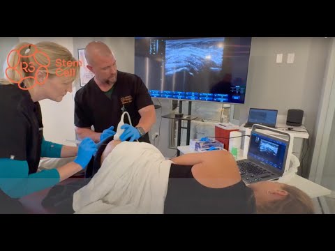 How R3 Stem Cell Performs a Hip Pain Procedure +1(844) GET-STEM