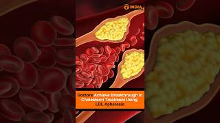Doctors Achieve Breakthrough in Cholesterol Treatment Using LDL Apheresis