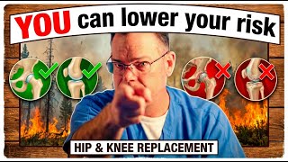 Hip & Knee Replacement: Lower Your Risks You Have More Control Than You Think