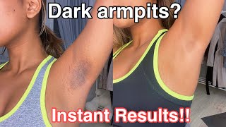 How To Get Rid Of Dark Armpits INSTANTLY! 100% works