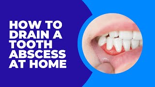 Should you Drain a Tooth Abscess at Home?
