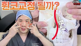 코상담전 필수시청❗휜코교정 안된다고.. ? #아이루미성형외과