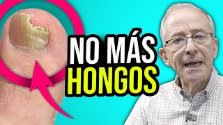 🦶 REMEDIOS PARA CURAR HONGOS En Pies Y Niños - Oswaldo Restrepo RSC