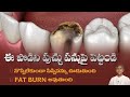 Dental Cavities | How to Reduce Tooth Decay Pain | Pippi Pannu Remedy | Dr. Manthena's Health Tips