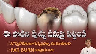 Dental Cavities | How to Reduce Tooth Decay Pain | Pippi Pannu Remedy | Dr. Manthena