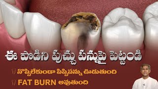 Download lagu Dental Cavities | How to Reduce Tooth Decay Pain | Pippi Pannu Remedy | Dr. Manthena's Health Tips mp3 Download lagu Dental Cavities | How to Reduce Tooth Decay Pain | Pippi Pannu Remedy | Dr. Manthena's Health Tips mp3