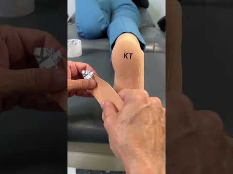 How Taping Helps Plantar Fasciitis
