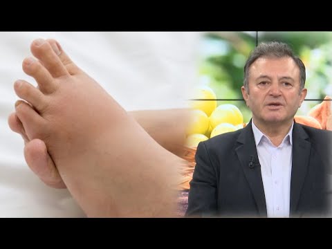 Keni enjtje të këmbëve? Kujdes, ja si duhet trajtuar në kushtet e shtëpisë