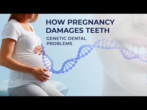 How Pregnancy Ruined My Teeth – What You Should Know About Genetics and Dental Problems