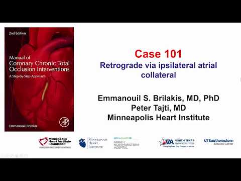Case 101: Manual of CTO Interventions: Retrograde via ipsilateral atrial collateral
