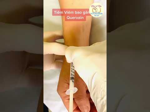 Tiêm gân điều trị đau cổ tay do viêm bao gân cơ dạng dài, duỗi ngắn ngón cái