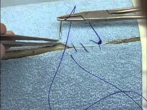 Continuous Suture Patterns: Simple Continuous