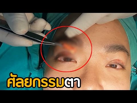 โรคสะเก็ดเงินขนมปังข้าวไรย์ นิยามโรคสะเก็ดเงิน