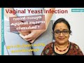 Vaginal Yeast Infection (ഫംഗസ് ) വരാനുള്ള സാധ്യത കൂടുതൽ ഉണ്ട