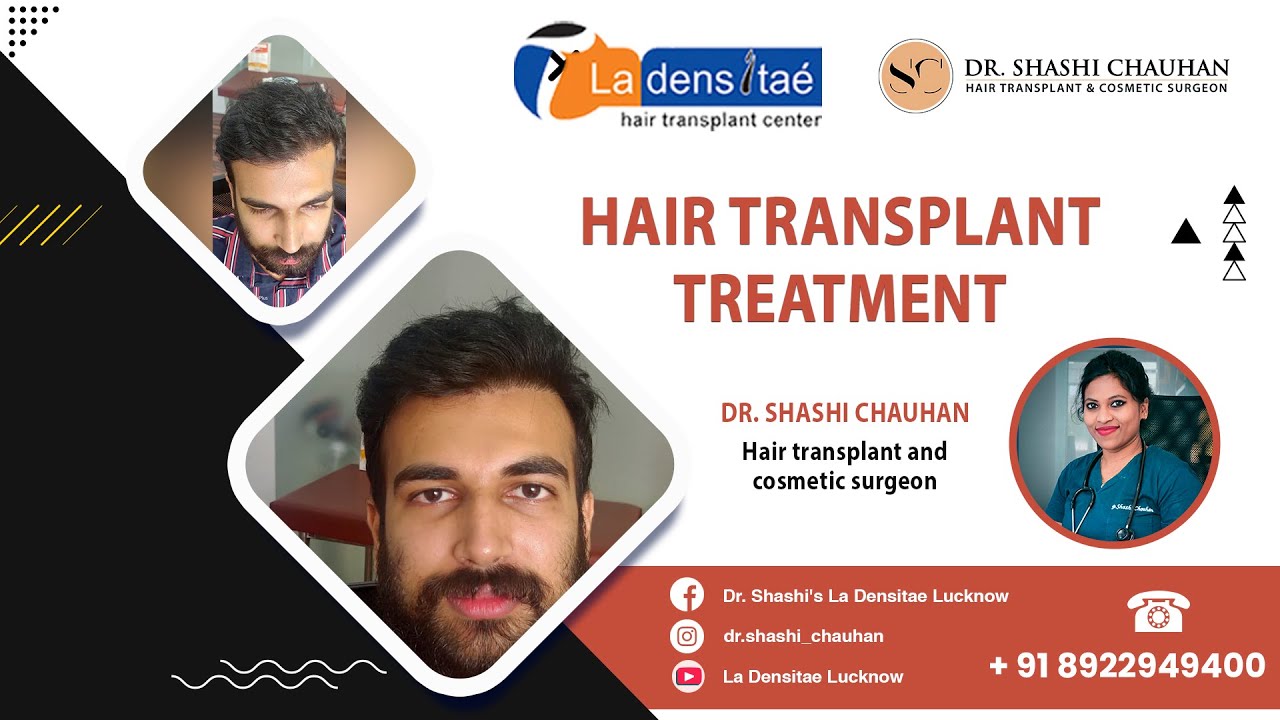 Hair Transplant Before and After | Hair Transplant in Lucknow | Dr. Shashi Chauhan | La Densitae