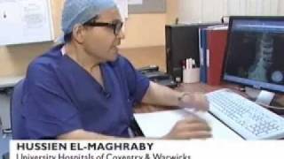 Keyhole Spinal Surgery Lumbar fracture BBC news Hussien El-Maghraby UHCW