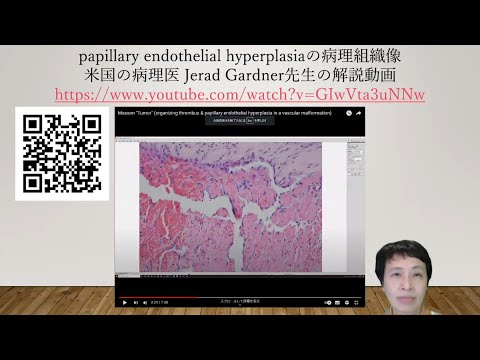 希釈(ホメオパシー)について詳しく解説