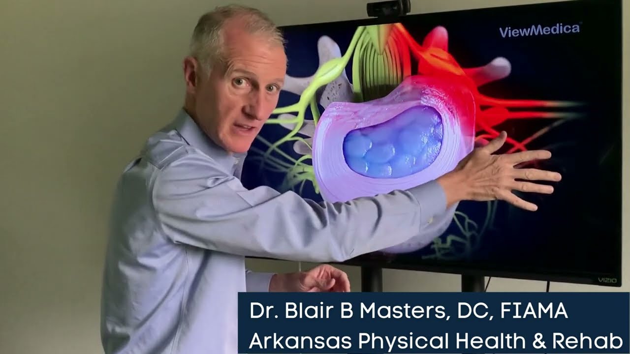 Sciatic Pain - Lumbar Radiculopathy