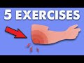 FIX Tendonitis - 5 Exercises | Heal and Prevent Elbow Pain