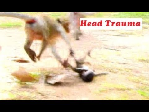 Million Pity! Poor Baby Daniela Became Head Trauma  By  Deedee