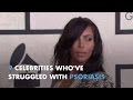 9 Celebrities Who Struggle With Psoriasis