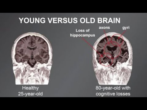 Gerry Leisman Young and Old Brains