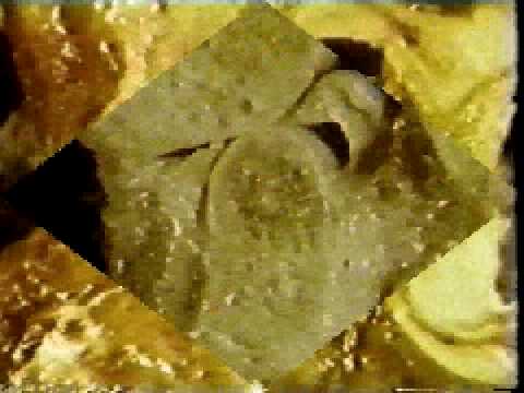 Displasia dellanca e lesercito Il dolore delle donne osso sacro