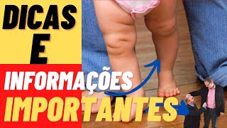 Como trata o raquitismo alternativamente ao tratamento mdico, dicas e informaes importantes !!!