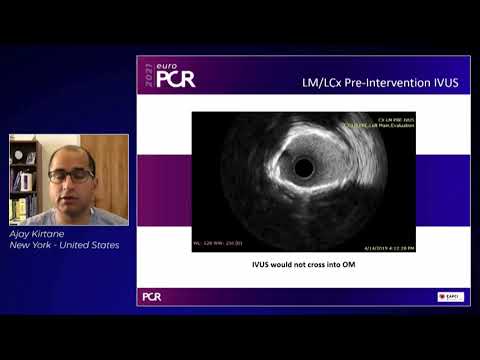 Latest insights: when to choose orbital atherectomy - EuroPCR 2021