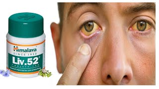 Liv 52 Tablet = BEST * Tablet for Liver problem | पीलिया, टाइफाइड, भूक न लगने की समस्या जो सही करे