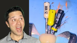 If You Retreat Root Canals You MUST Watch this......