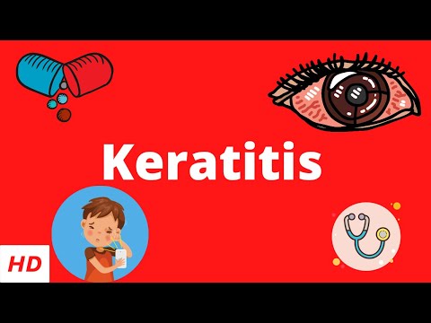 Far sightedness Causes Signs and Symptoms Diagnosis and Treatment