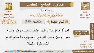 صورة 149   هل الدم النازل بعد الإجهاض نفاس؟ للإمام ابن باز