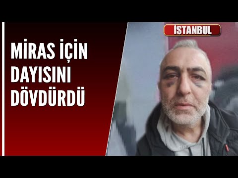 MİRAS İÇİN DAYISINI DÖVDÜRDÜ