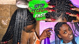 Box Braid Series: Stop itchy scalp FAST | alexuscrown