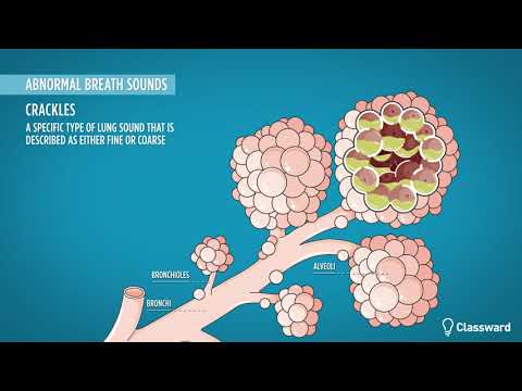 Coarse and Fine Crackles